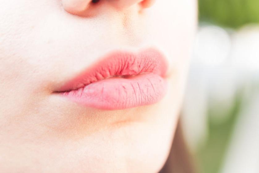 Ini 4 Cara Mengatasi Bibir Kering Saat Puasa - Womantalk